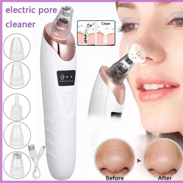5-in-1 Electric Blackhead Remover – Deep Cleansing Blackhead & Pore Remover for Nose & Face